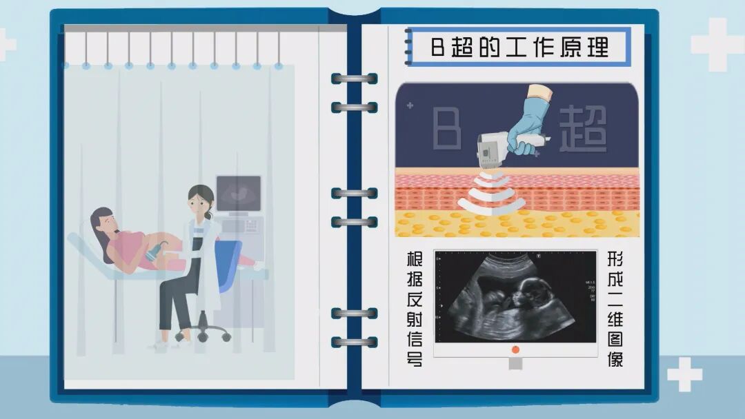 b超仪器什么牌子好诊断+治疗多面手，这一“宝藏”仪器您了解吗？_https://www.jmylbn.com_新闻资讯_第6张