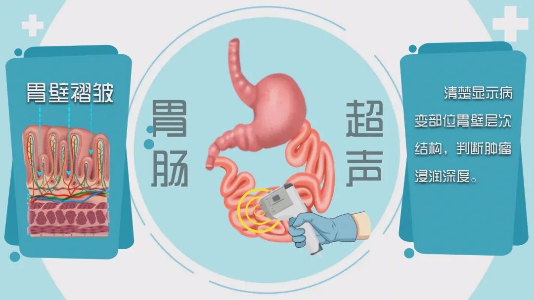 b超仪器什么牌子好诊断+治疗多面手，这一“宝藏”仪器您了解吗？_https://www.jmylbn.com_新闻资讯_第8张