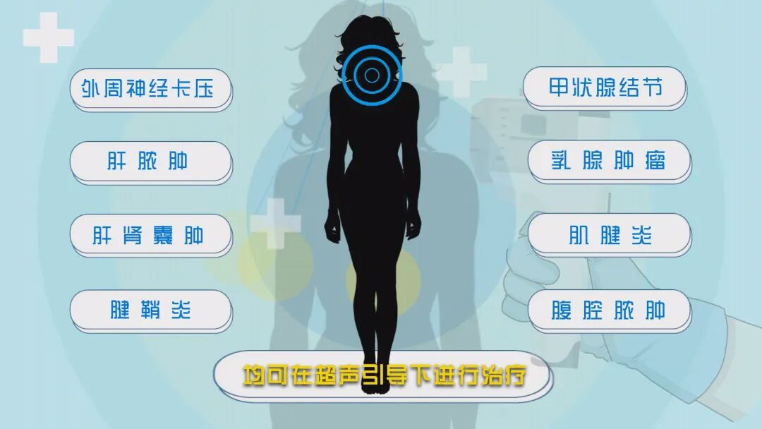 b超仪器什么牌子好诊断+治疗多面手，这一“宝藏”仪器您了解吗？_https://www.jmylbn.com_新闻资讯_第11张