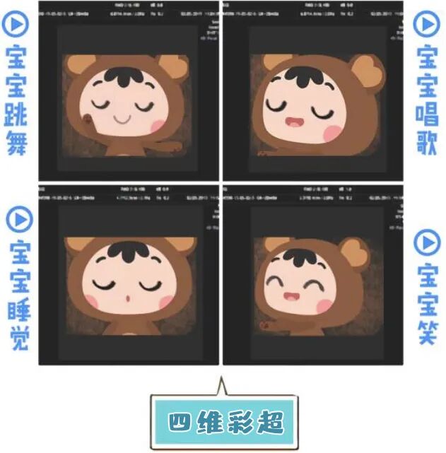 三星彩超怎么样【便民服务】四维彩超界“新王者”——三星HERA女神超声仪，给孕妈妈们一份安心！_https://www.jmylbn.com_新闻资讯_第30张