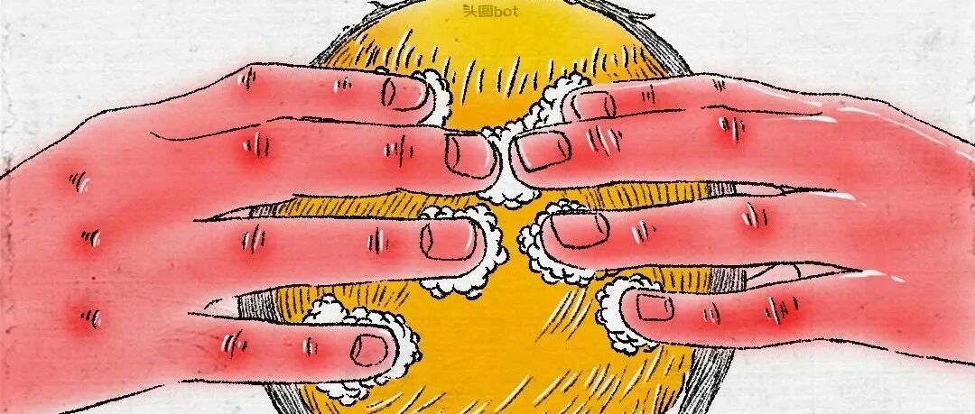 “ 我的新年愿望是脱单，不是脱发”