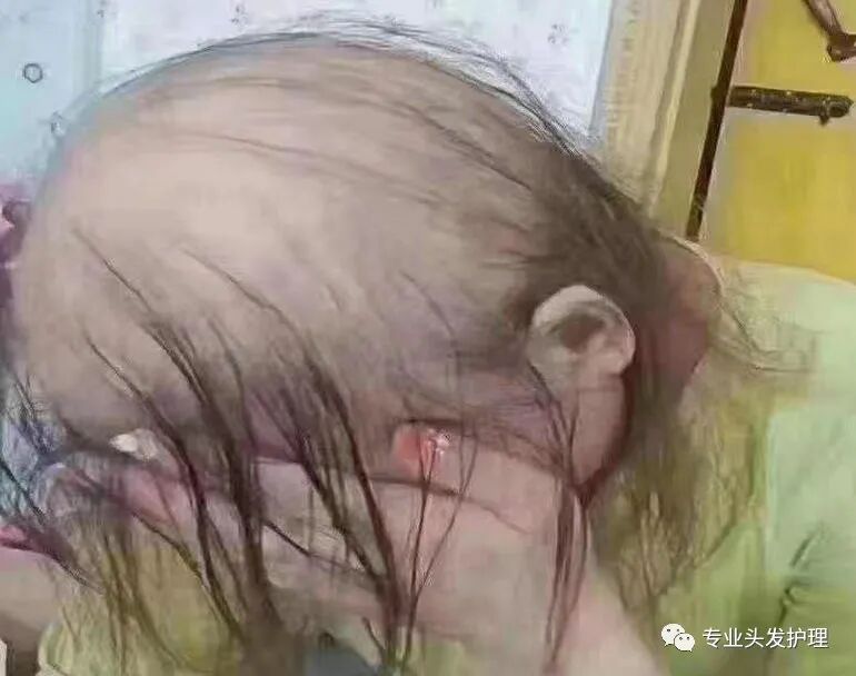 冬季护发养发更关键！