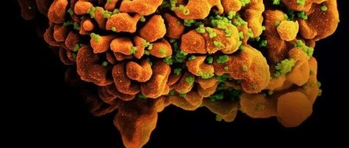 艾滋病病毒新变种来了！毒性和破坏性极强