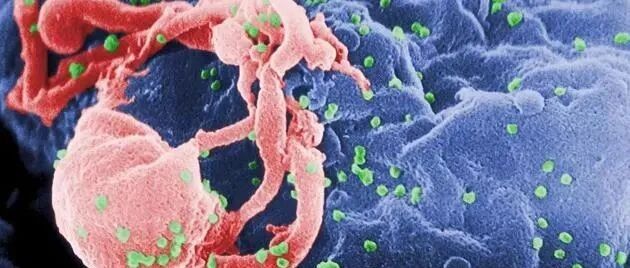 全球首例！一位艾滋病女性被彻底治愈！