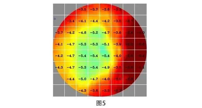 助力近视防控，我院眼科引进MRT多光谱屈光地形图