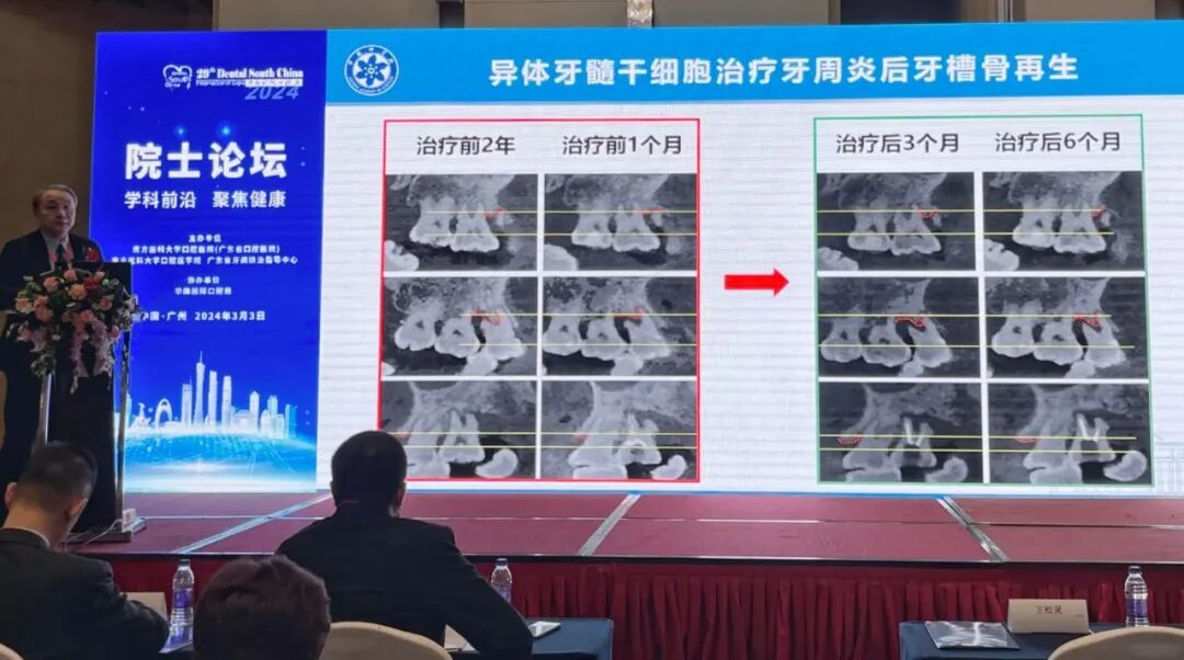 王松灵院士最新分享！牙髓干细胞在促使再生生物牙根和神经修复方面大有可为(图3)
