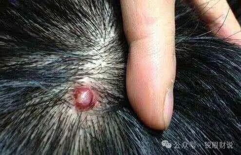 头皮里，老是长疙瘩和脓包，是怎么了？提醒：或是4种疾病警报