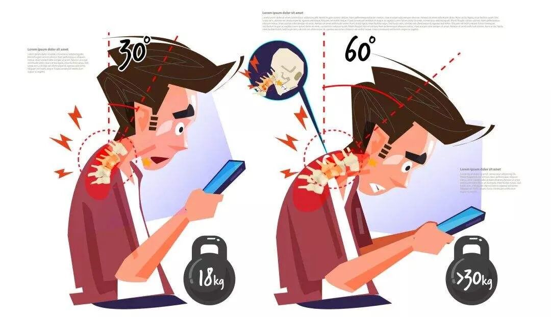 久坐族低头族手机党别整垮你的生命支柱