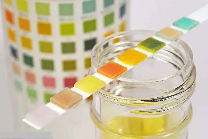 poct什么意思三大常规检查之一的尿常规，检查单你看的懂吗？了解一下每个项目代表的意思吧！_https://www.jmylbn.com_新闻资讯_第7张