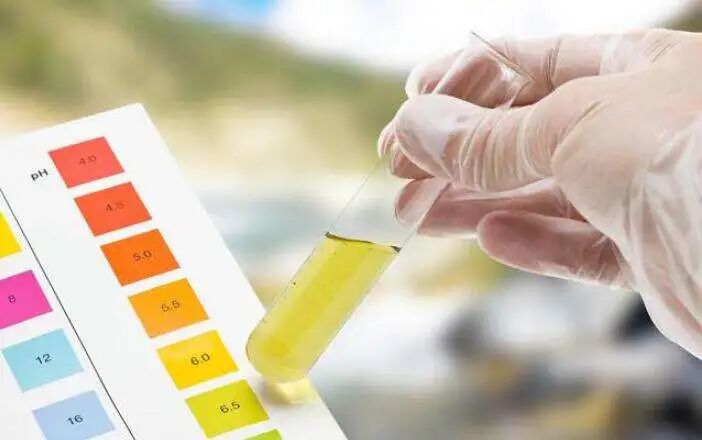 poct什么意思三大常规检查之一的尿常规，检查单你看的懂吗？了解一下每个项目代表的意思吧！_https://www.jmylbn.com_新闻资讯_第9张