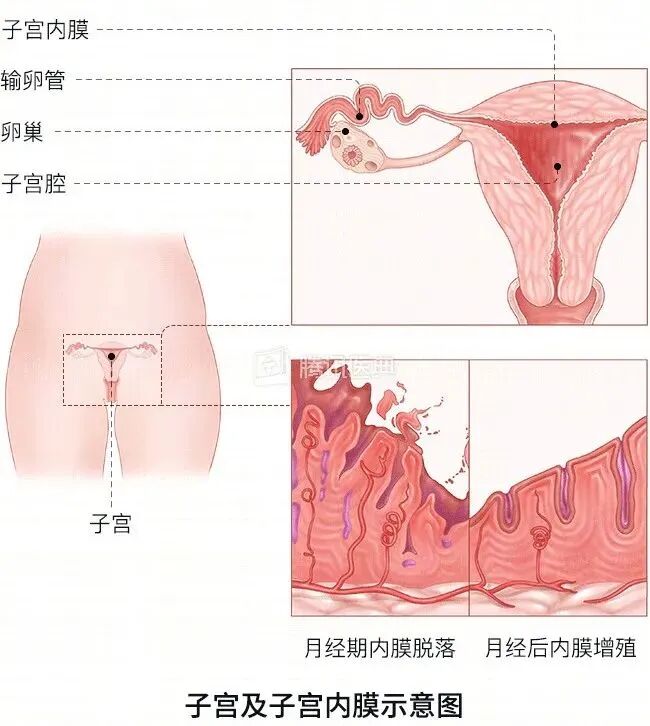 痛经越来越严重，那你要小心“它”了！