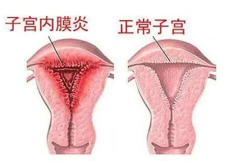 导致试管不着床的8个原因你中了吗?