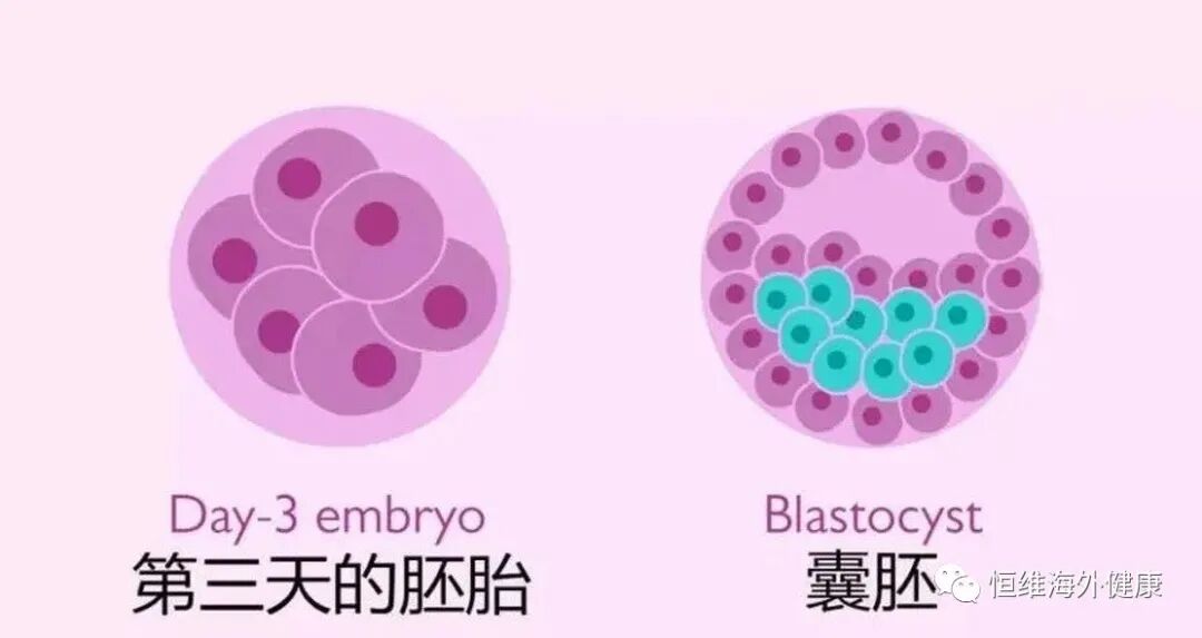 试管百科：难过“高考”，逼哭选择恐惧症的试管养囊！