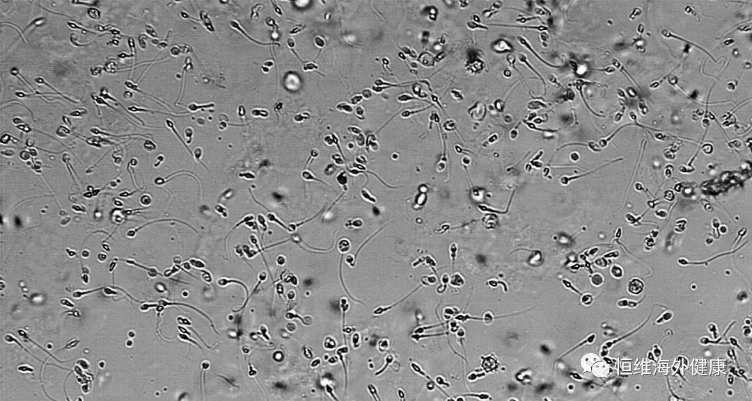 男性生育力大幅度下降，少精、弱精、无精的生育“男”题该怎么解？