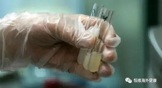 和弱精症说“再见”！用试管婴儿一招搞定弱精“男题”