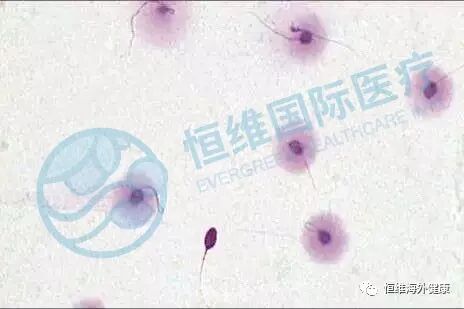 精子也会「掉链子」，不碎才是真的高质量男性！