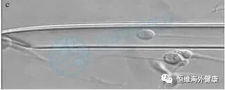 精子也会「掉链子」，不碎才是真的高质量男性！