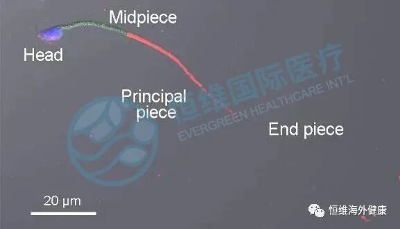 精子也会「掉链子」，不碎才是真的高质量男性！