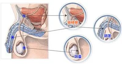 容易忽略的不孕不育原因——抗精子抗体!