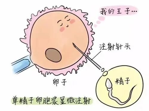 容易忽略的不孕不育原因——抗精子抗体!