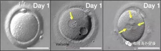 试管冷知识 | 为什么我的卵子这么多，却只配成几个胚胎？