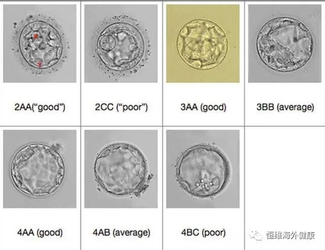 分钟带你了解胚胎级别，科学评估试管婴儿成功率！"