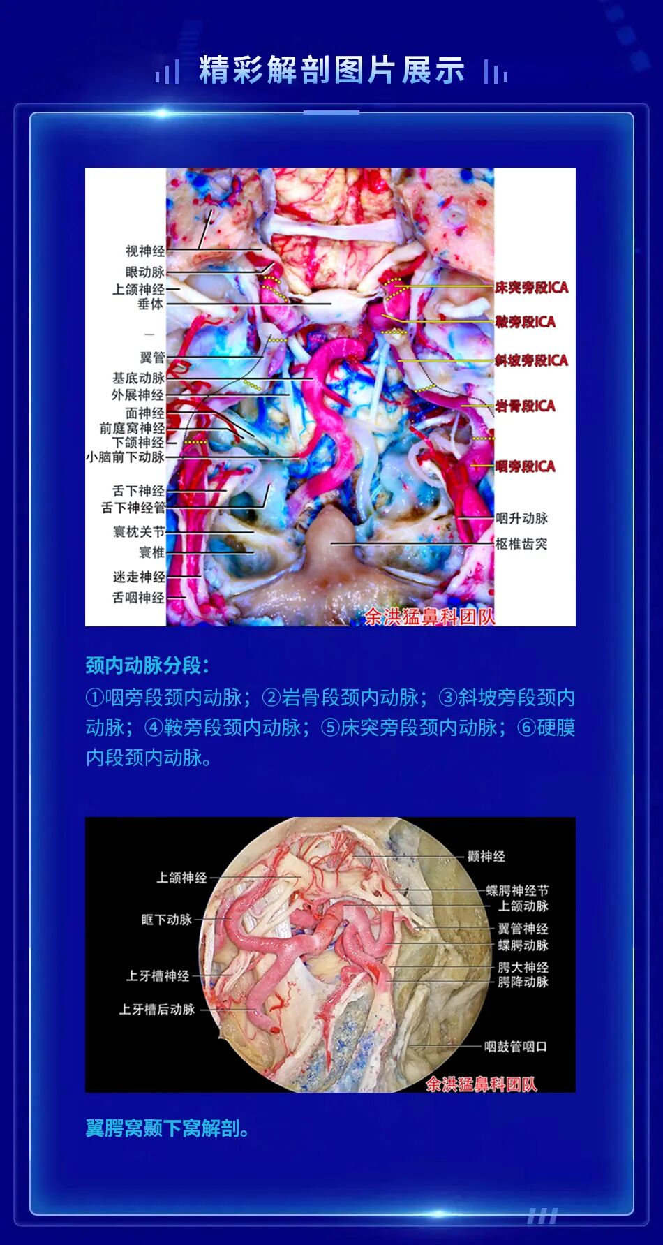 karlstorz待遇怎么样【今日09：00解剖直播】KARLSTORZ 4K／3D鼻内镜及口内镜解剖演示-2022中国鼻咽癌外科论坛及头颈肿瘤MDT研讨会_https://www.jmylbn.com_新闻资讯_第14张