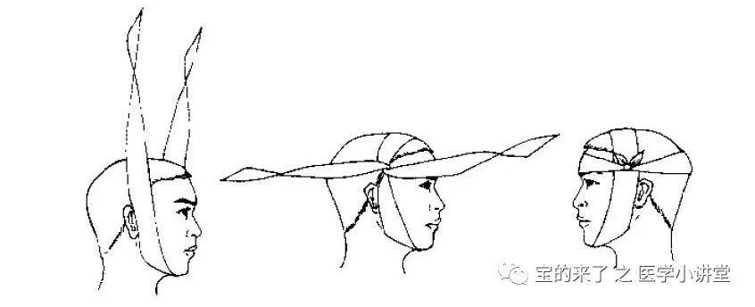 医用纱布绷带怎么绑急救知识 ｜ 绷带及三角巾包扎法_https://www.jmylbn.com_新闻资讯_第18张