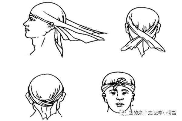 医用纱布绷带怎么绑急救知识 ｜ 绷带及三角巾包扎法_https://www.jmylbn.com_新闻资讯_第12张