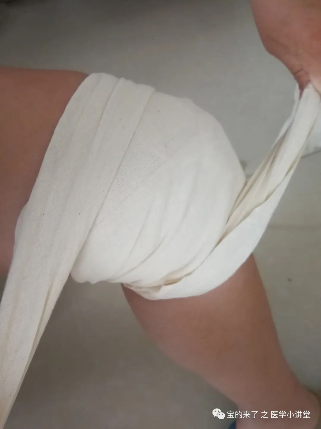 医用纱布绷带怎么绑急救知识 ｜ 绷带及三角巾包扎法_https://www.jmylbn.com_新闻资讯_第30张