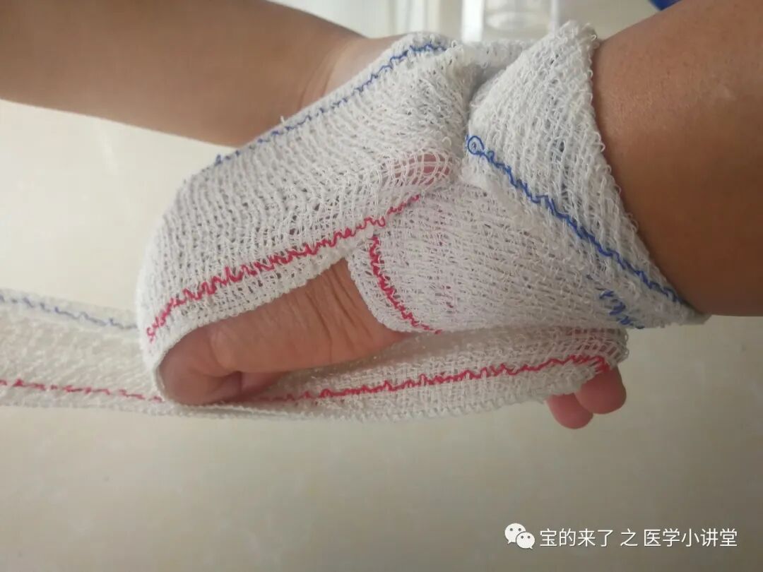 医用纱布绷带怎么绑急救知识 ｜ 绷带及三角巾包扎法_https://www.jmylbn.com_新闻资讯_第6张