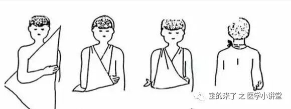 医用纱布绷带怎么绑急救知识 ｜ 绷带及三角巾包扎法_https://www.jmylbn.com_新闻资讯_第25张
