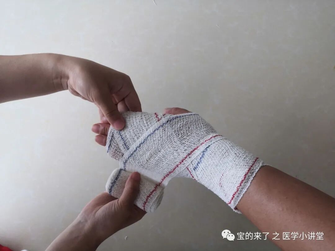 医用纱布绷带怎么绑急救知识 ｜ 绷带及三角巾包扎法_https://www.jmylbn.com_新闻资讯_第10张