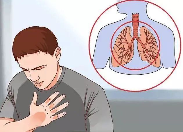 肺部结节 肺部结节