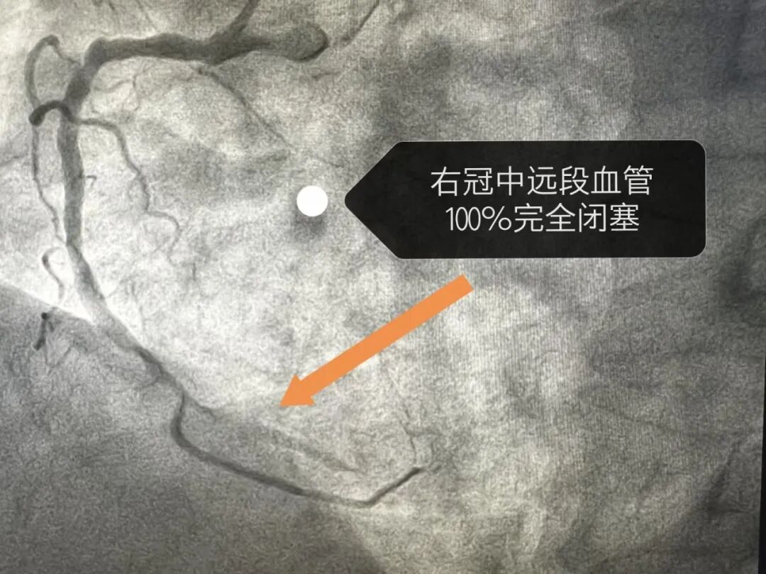 9e0ba0a48e5fea95a43cc5d158a7bac0.jpg