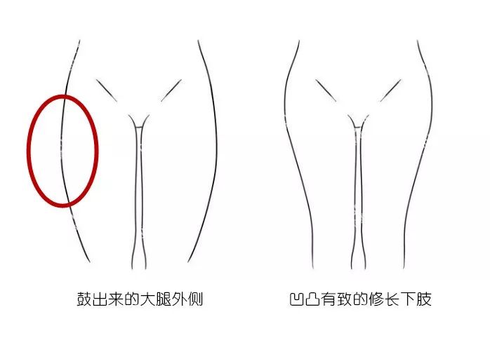 健身常識 |大腿顯粗？很可能是骨頭的原因哦！ 運動 第4張