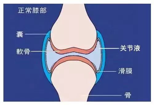 正常关节里有“水”吗？关节腔积液的症状？
