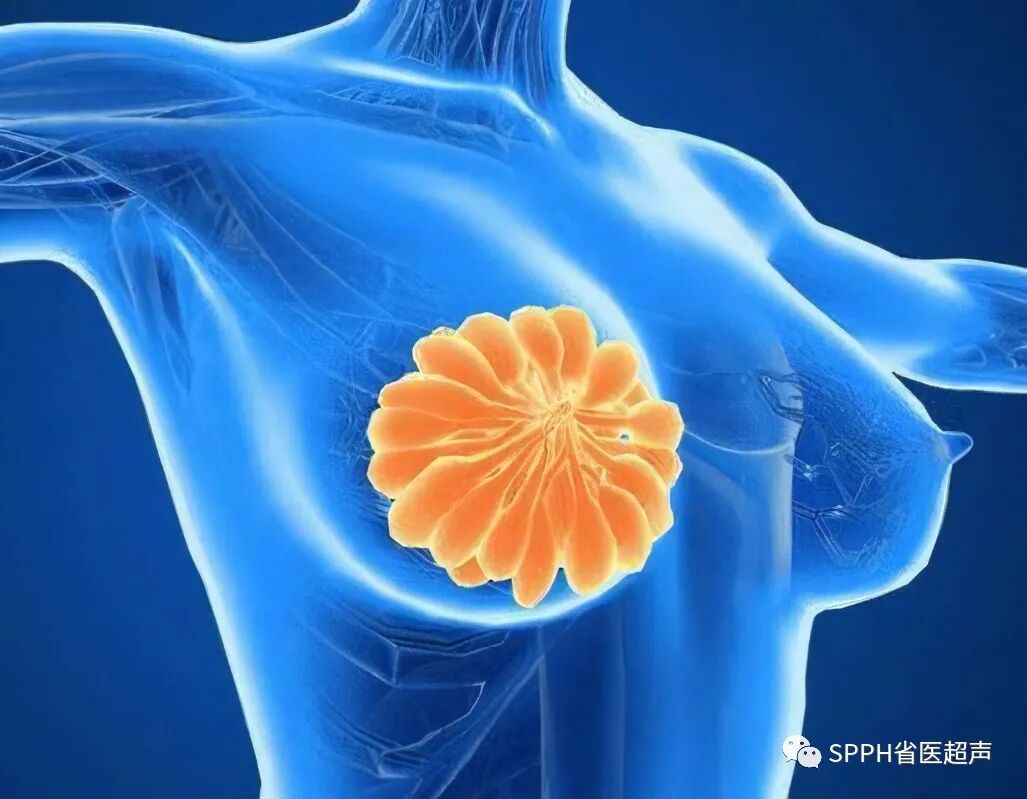 什么是容积成像自动乳腺容积超声成像 ABUS-上海聚慕医疗器械有限公司