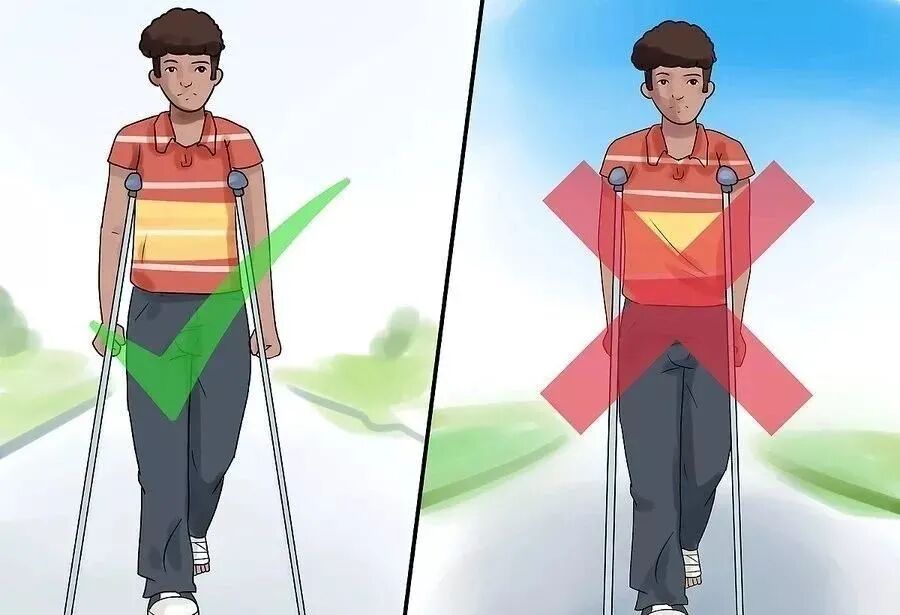 肘拐怎么用康复鲁西｜这堂课，教您正确用拐杖_https://www.jmylbn.com_新闻资讯_第8张