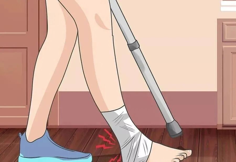 肘拐怎么用康复鲁西｜这堂课，教您正确用拐杖_https://www.jmylbn.com_新闻资讯_第12张