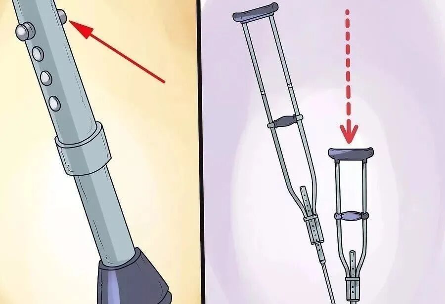 肘拐怎么用康复鲁西｜这堂课，教您正确用拐杖_https://www.jmylbn.com_新闻资讯_第3张