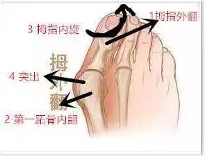 夏天到了！你还在为这种病困扰吗？