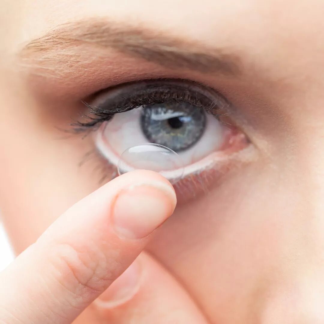 易过敏者尽量不要配戴隐形眼镜