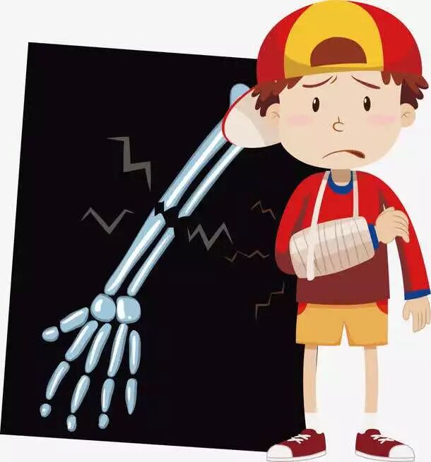 闭合性骨折与开放性骨折怎样急救处理