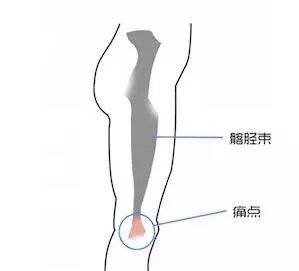 膝盖越动越痛是怎么回事？