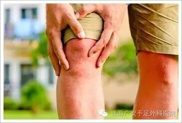 跷二郎腿有损膝关节健康，  请收回你的二郎腿！