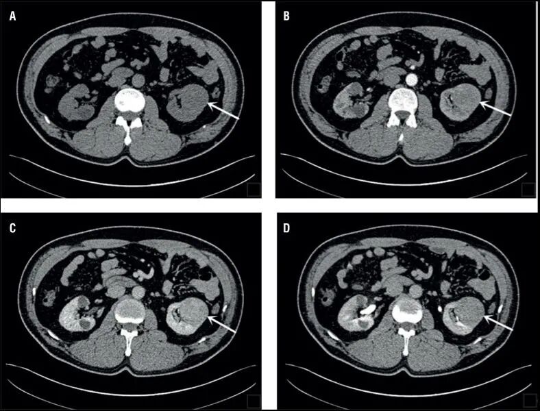 dr在彩超什么意思一文搞懂X线、CT、MR、彩超检查的区别_https://www.jmylbn.com_新闻资讯_第13张