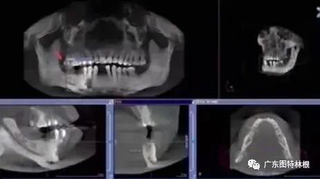 20181018868040 拷贝.jpg