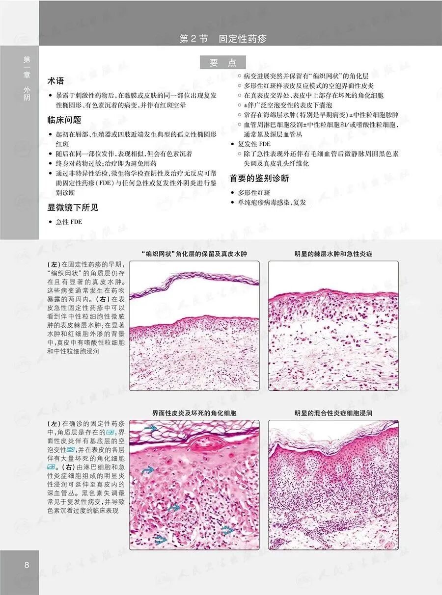 怎么买病理图文遇“荐”好书｜｜一本妇科病理诊断必备案头书：《妇科病理诊断学》_https://www.jmylbn.com_新闻资讯_第14张