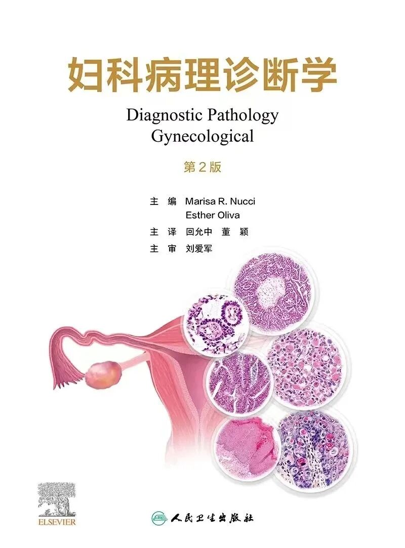 怎么买病理图文遇“荐”好书｜｜一本妇科病理诊断必备案头书：《妇科病理诊断学》_https://www.jmylbn.com_新闻资讯_第4张